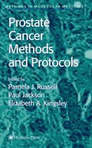 Prostate Cancer Methods and Protocols