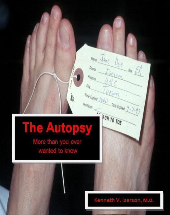 The Autopsy: More than you ever wanted to know - cover