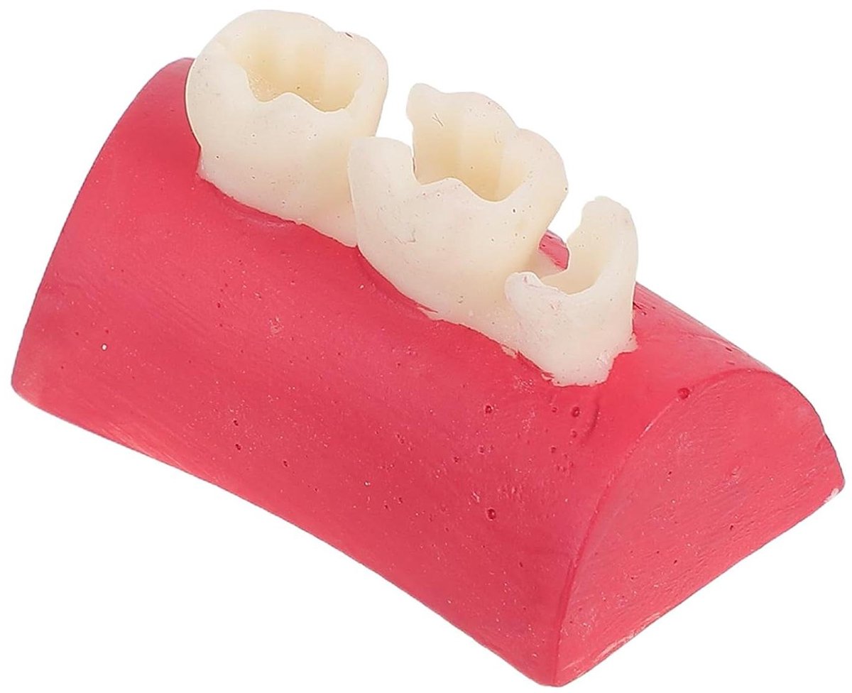 Tanden Oefenmodel - Wortelkanaal Training - Tandheelkundig Leren - Realistische Anatomie - 4.5 cm - Transparant