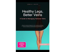 Healthy Legs, Better Veins: A Guide to Managing Varicose Veins
