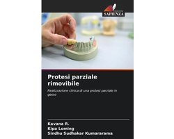 Protesi parziale rimovibile