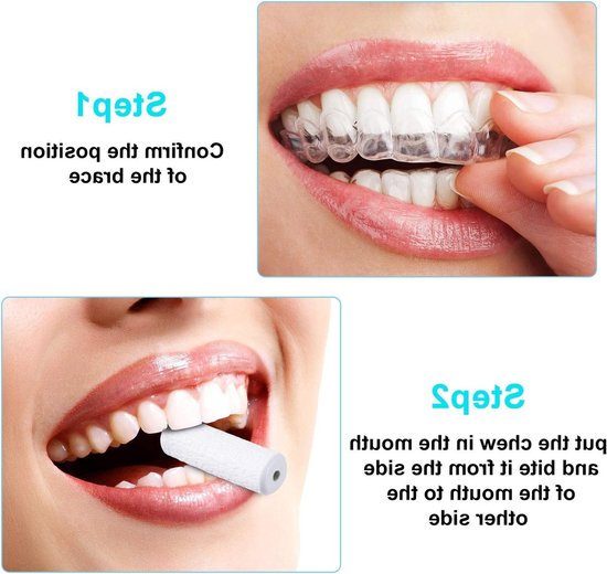 20 Stuks Aligner Tray Chewies voor Orthodontische Beugels - Verkrijgbaar in 5 Kleuren, Ideaal voor Comfort en Ondersteuning — afbeelding 4