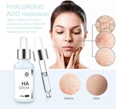 Hyaluronzuur Serum - Hyaluronic Acid Serum - Gezichtscreme - Anti Aging - Anti Rimpel - Wallen – Acne – Droge Huid Olie – Gevoelige Huid – Huidverzorging