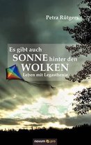 Es gibt auch Sonne hinter den Wolken