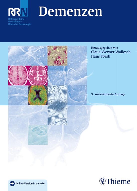 Referenzreihe Neurologie - Demenzen - cover