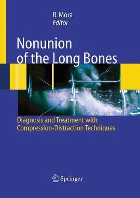 Nonunion of the Long Bones - cover