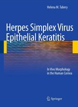 Medicine (R0) - Herpes Simplex Virus Epithelial Keratitis