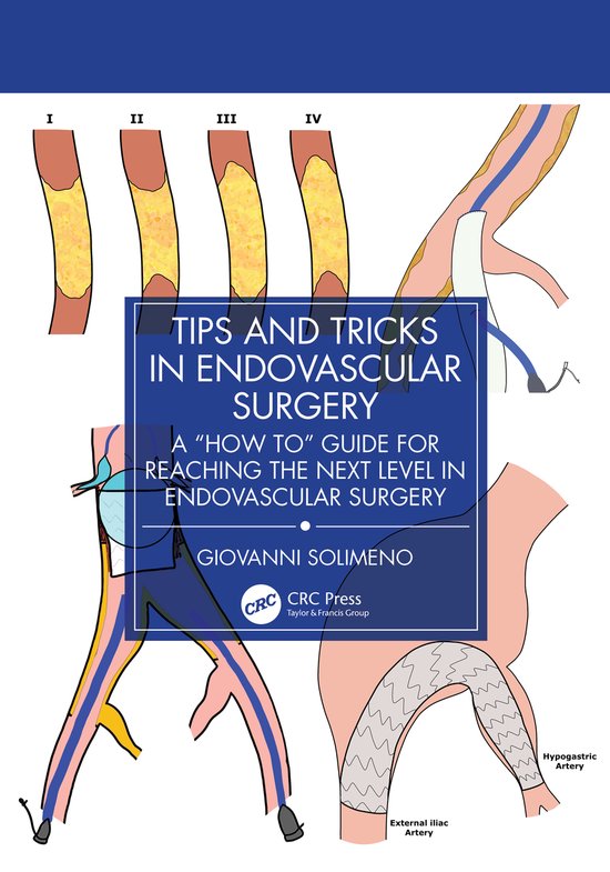 Boekomslag met de titel "Tips and Tricks in Endovascular Surgery", illustraties van bloedvaten en chirurgische ingrepen.