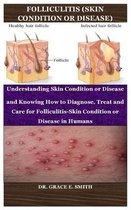 Folliculitis (Skin Condition or Disease)