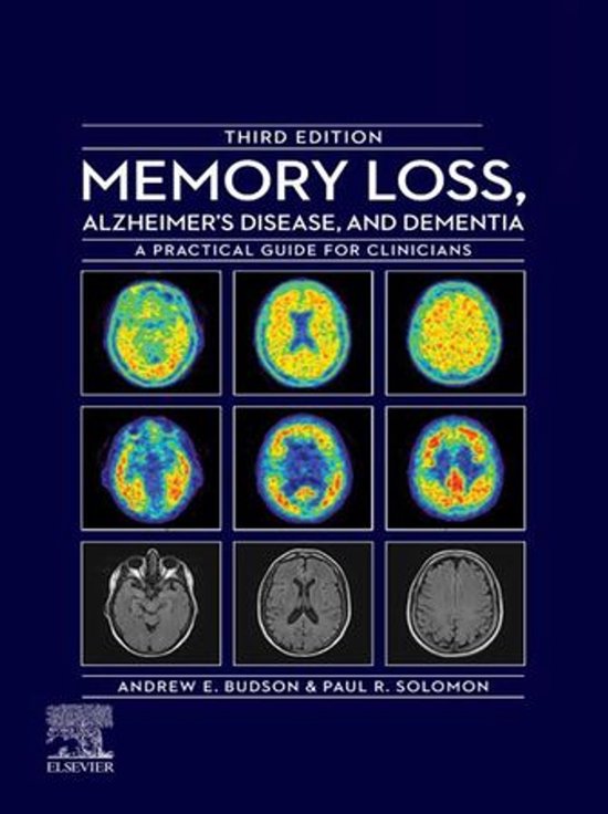 Memory Loss, Alzheimer's Disease, and Dementia - E-Book - cover