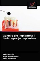 Gojenie się implantów i biointegracja implantów
