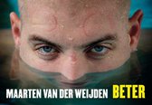 Beter