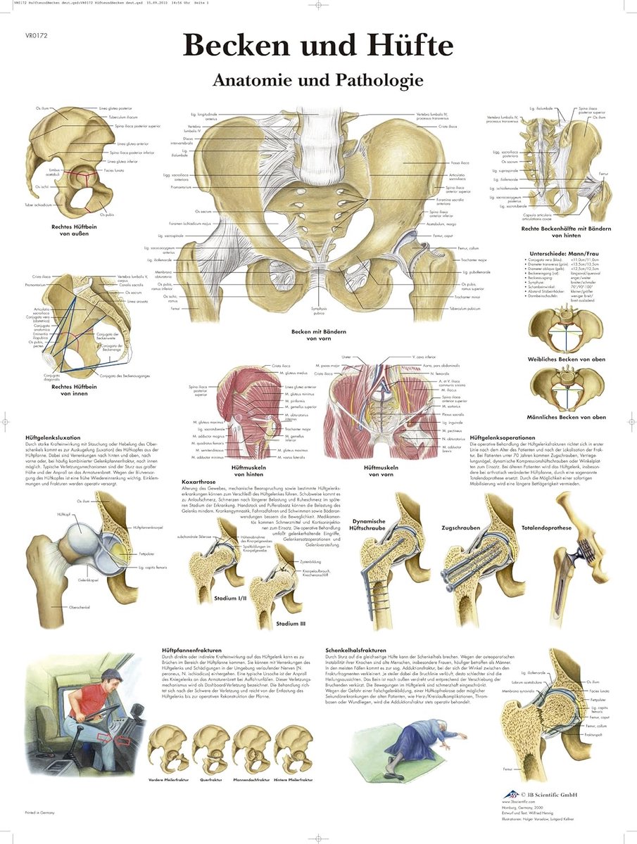 Anatomie Poster Bekken en Heup - Gelamineerd Overzicht van Structuur en Pathologie