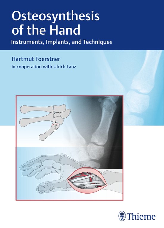 Osteosynthesis of the Hand - cover