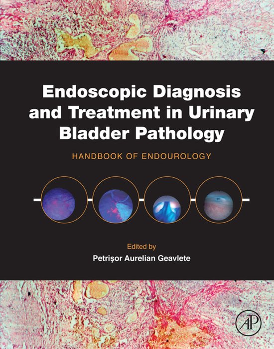 Endoscopic Diagnosis and Treatment in Urinary Bladder Pathol ... - cover