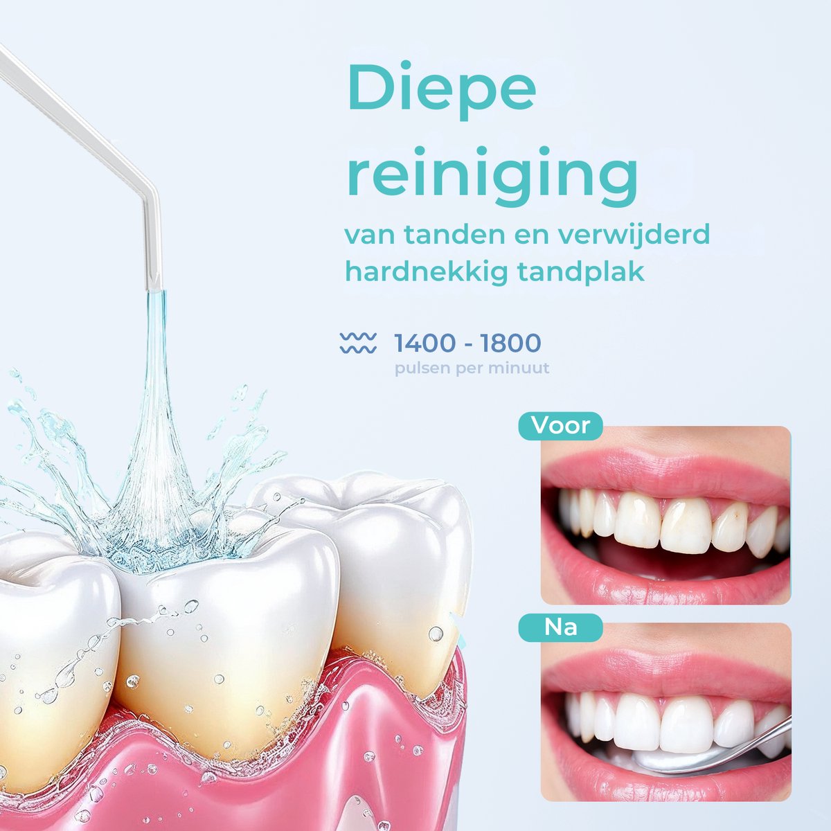 Mondura Waterflosser Draadloos thumbnail 2