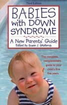 Babies with Down Syndrome