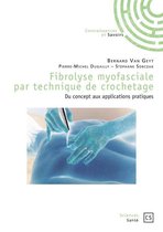Fibrolyse myofasciale par technique de crochetage