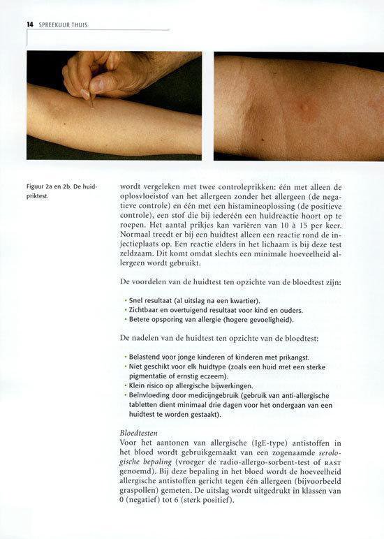 Kinderen en allergie