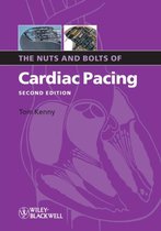 Nuts & Bolts Of Cardiac Pacing