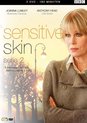 Sensitive Skin - Seizoen 2