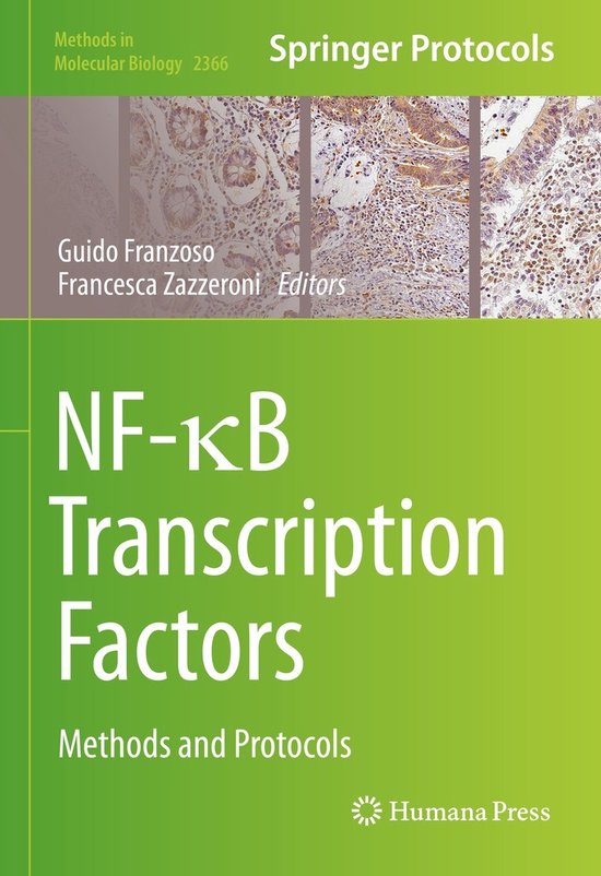 NF kB Transcription Factors | 9781071616680 | Guido Franzoso, Francesca ...