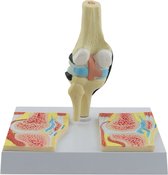 Het menselijk lichaam - anatomie model knie met reuma