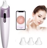 Blackhead Remover - Met Ingebouwde Camera - Puisten verwijderaar - Gezichtsreiniger - Poriën Reiniger  - Mee Eters Verwijderaar - Puisten - Acne - Gladde Huid - Gezonde Huid - Werk