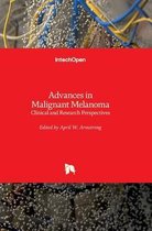Advances in Malignant Melanoma