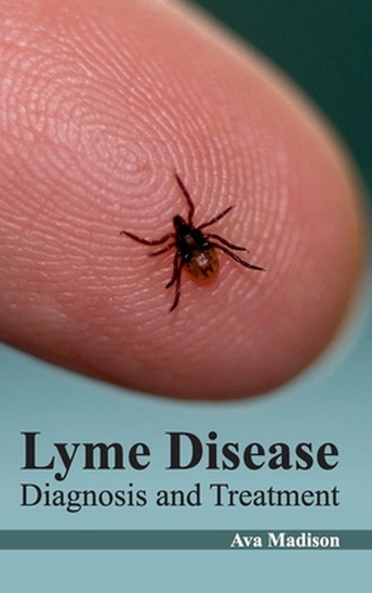 Lyme Disease Diagnosis and Treatment 9781632422620 Boeken
