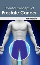 Essential Concepts of Prostate Cancer