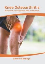 Knee Osteoarthritis: Advances in Diagnosis and Treatment