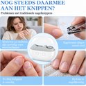 Vergelijking: nadelen van traditionele nagelknippers versus de witte elektrische nagelknipper.