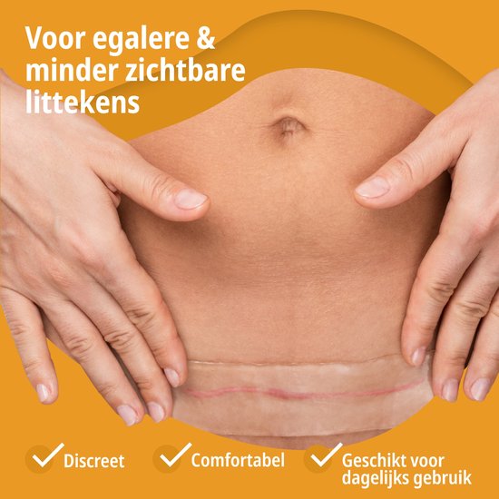 Vrouw toont een keizersnede litteken met een discrete siliconen pleister.