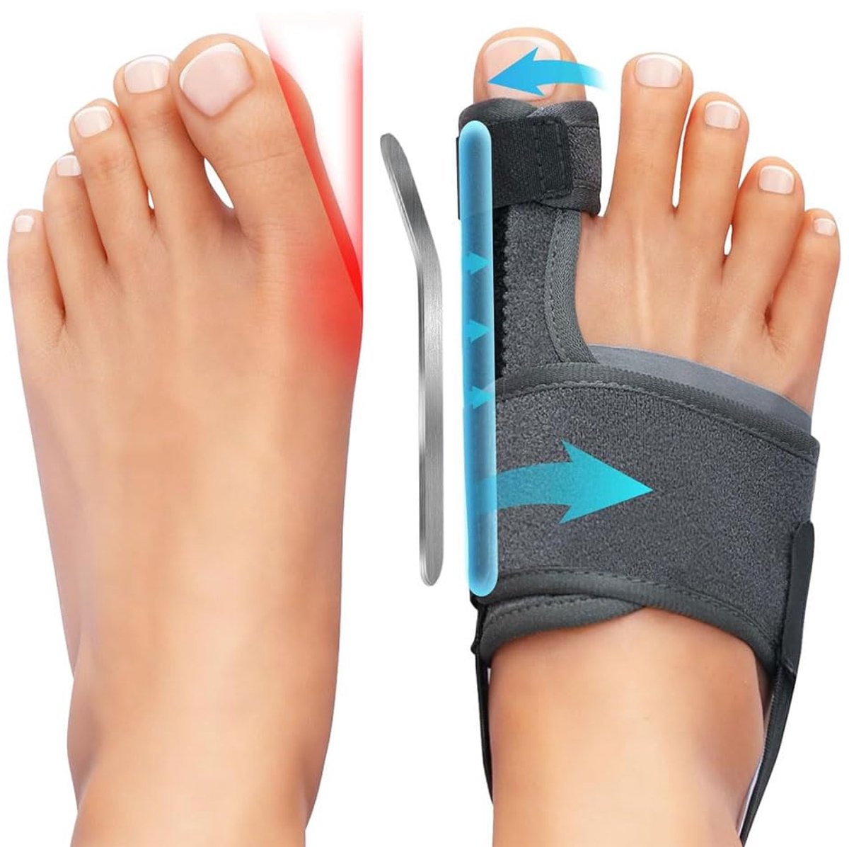 1 Paar Hallux Valgus Orthese Correctieve Teenscheider Teenspreader voor Vrouwen en Mannen Herbruikbaar Teenrechter Gebruik Dag en Nacht Pijnbescherming (Grijs)