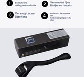 Derma Roller 540 Naalden Set - Verjong je Huid, Verminder Rimpels, Littekens en Hyperpigmentatie - Inclusief Handige Opbergbox - 1.5mm voor Optimaal Resultaat
