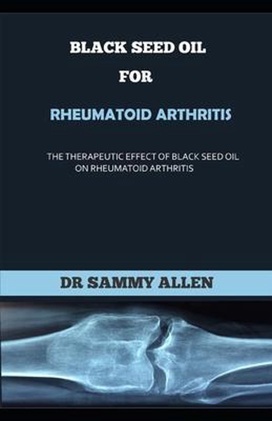 Black Seed Oil for Rheumatoid Arthritis, Dr Sammy Allen 9798641644318