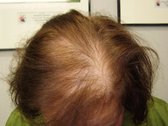 LA Labs Hair Pro bedekt dunner wordend/kaal haar - Lichtblond