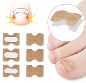 Teennagel Lifter – Ingegroeide Teennagel Corrector – 30 Teennagel Pleisters – Anti Ingroei Pleister – Nagel Correctie Kit – Pijnverlichtend & Eenvoudig in Gebruik