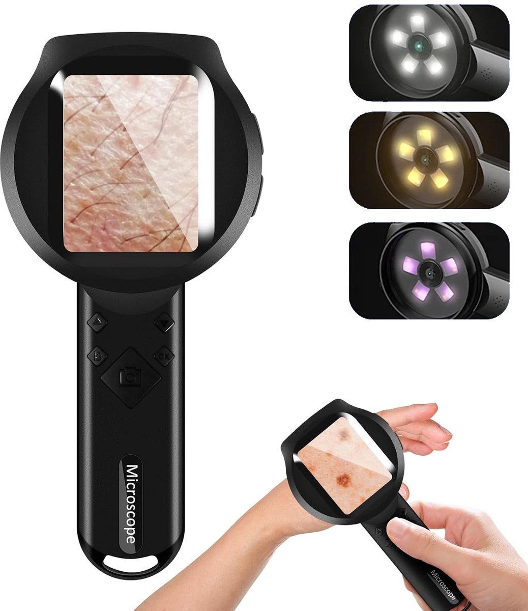 Handdermatoscoop - 100x Vergrootglas - Digitale Vergrootglas Met 3 Lichtbronnen - Digitale Microscoop Met 2,8 Inch IPS-Scherm