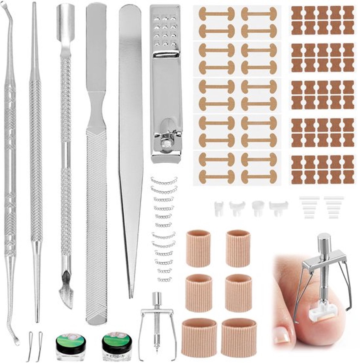 104-delige set ingegroeide teennagels, teennagelcorrectieset