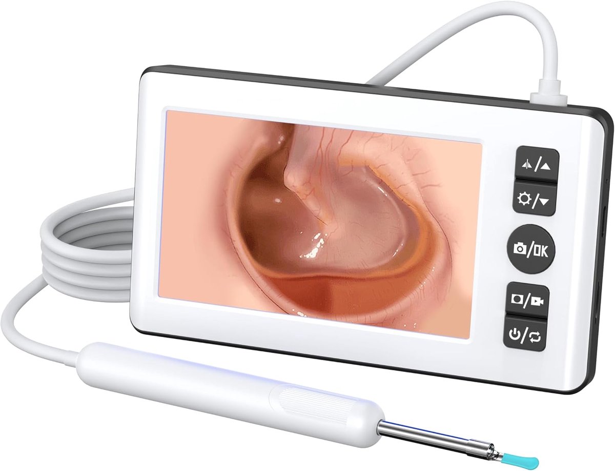 Deze digitale camera voor het verwijderen van oorsmeer heeft een 4,3-inch IPS-scherm, een 1080p HD-resolutie, een 2500 mAh-batterij en siliconen oordopjes, waardoor een telefoon overbodig is.
