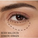 Onder het oog van een vrouw, met de nadruk op wallen en donkere kringen, aangegeven met stippellijnen.