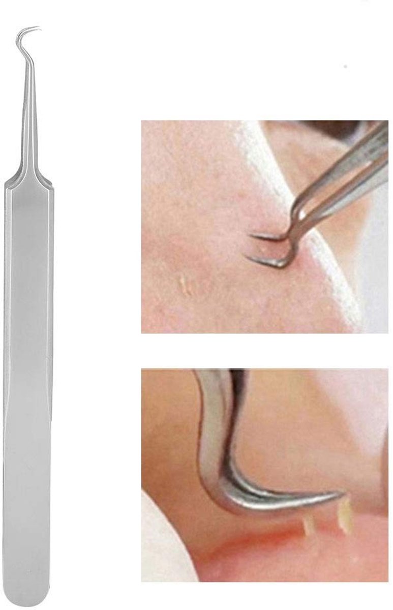 Dailygoods - Watris Veiyi Mee-eterpincet, precisie roestvrij staal, gebogen haak, comedonenlift, mee-eters, acne, puistjesverwijderaar, puistjesuitdrukkingsgereedschap, pincet mee-eterverwijderaar
