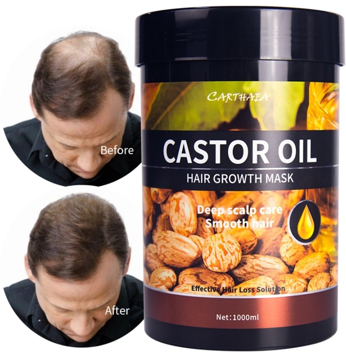 Castor Oil hair Growth mask