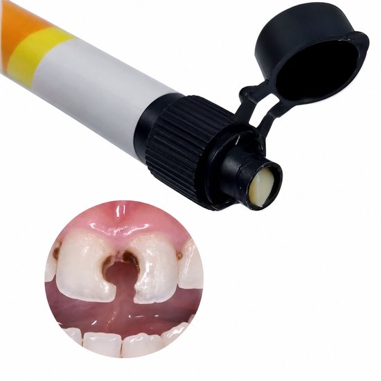 Tube met composiethars en applicator. Inset toont vergelijkbaar gat in tand, te repareren.