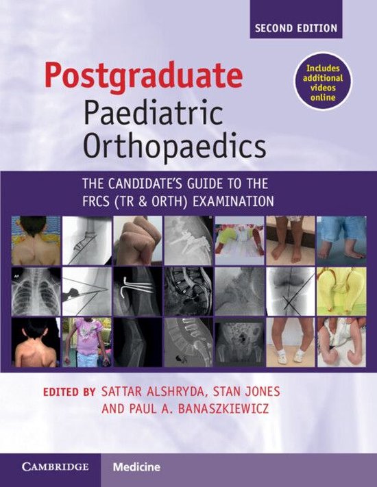 Postgraduate Paediatric Orthopaedics - cover