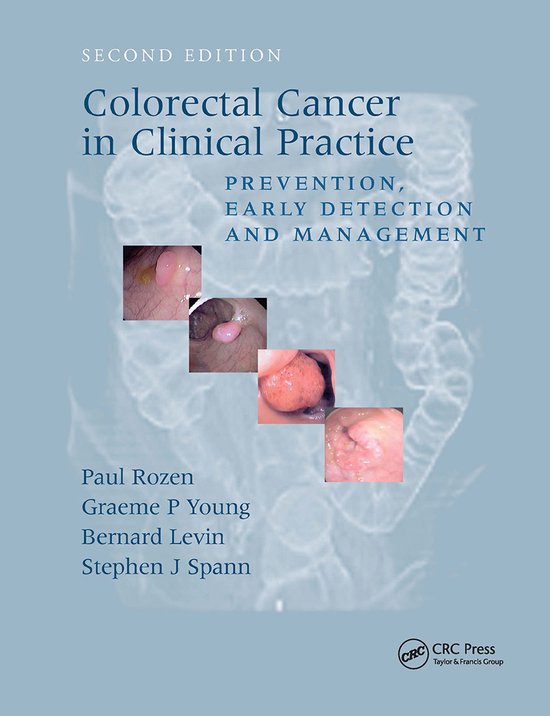 Foto: Colorectal cancer in clinical practice