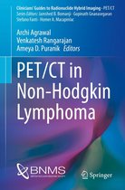 Clinicians’ Guides to Radionuclide Hybrid Imaging - PET/CT in Non-Hodgkin Lymphoma