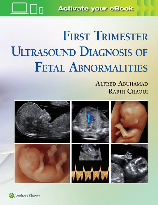 Foto: Atlas of ultrasound anatomy in late first trimester